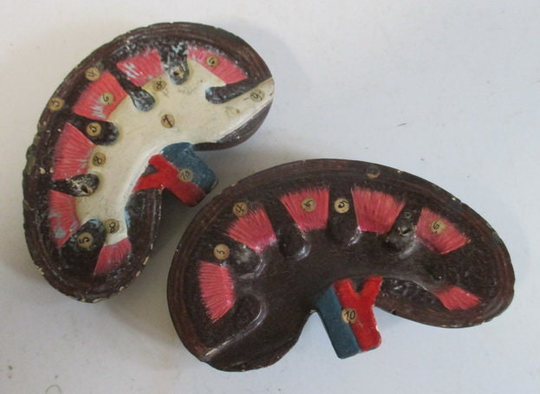 Antique Anatomical Model Of An Human Kidney