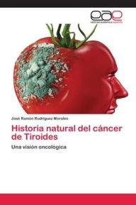 Historia natural del cáncer de Tiroides José Ramón Rodriguez Morales Author