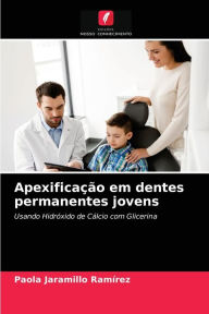 Apexificação em dentes permanentes jovens Paola Jaramillo Ramírez Author