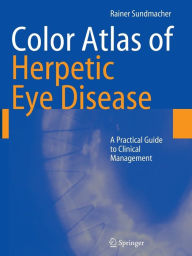 Color Atlas of Herpetic Eye Disease: A Practical Guide to Clinical Management Rainer Sundmacher Author