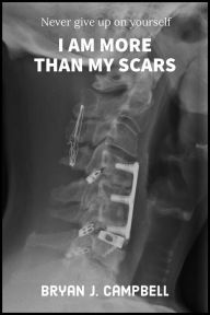 I Am More Than My Scars - Never Give Up On Yourself Bryan Campbell Author