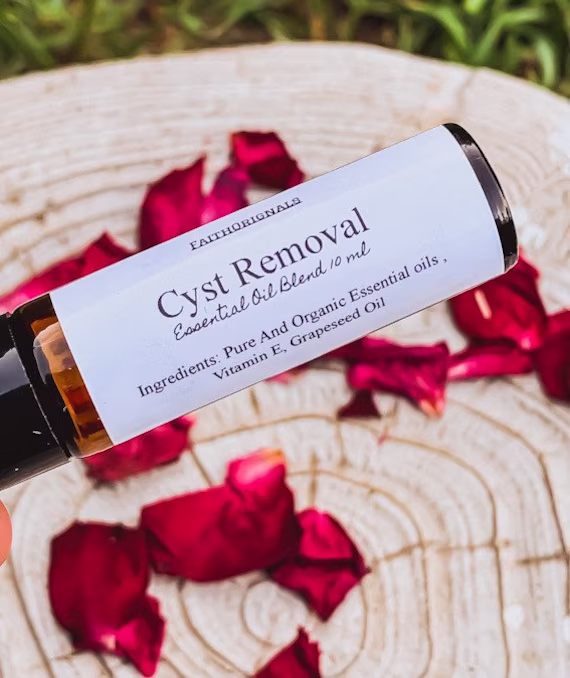 Cyst Removal Essential Oil Roll On Blend 10Ml, Therapeutic, Oils, All Natural, Skin Care, Self Gift