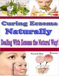 Curing Eczema Naturally David Colon Editor