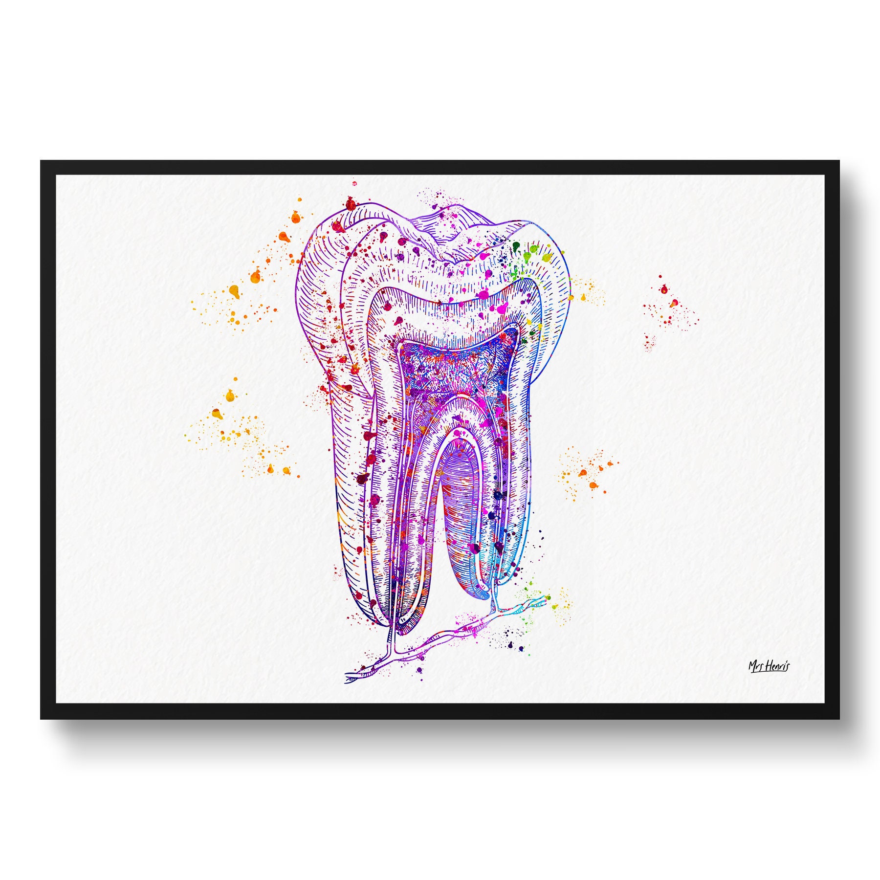 Tooth Structure Watercolour Print Cross Section Anatomy Dental Office Clinic Wall Art - Waiting Room Dentistry Gift