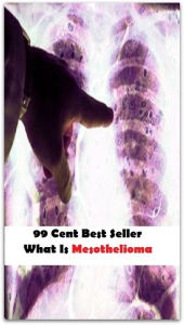 99 Cent Best Seller What Is Mesothelioma (Affiliate marketing,Online marketing, Art, Theology, Ethics, Chicken Soup, Thought, Theory, Self Help, Myste